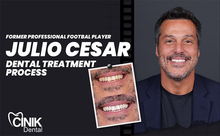 Julio Cesar
