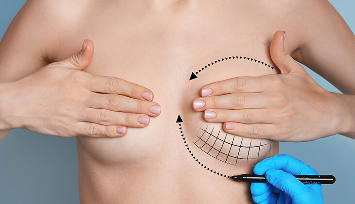 How to fix uneven breasts with breast surgery? - Hyundai Aesthetics Blog