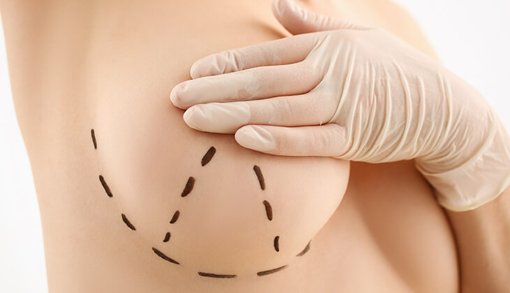 Breast Aesthetics DR. CINIK