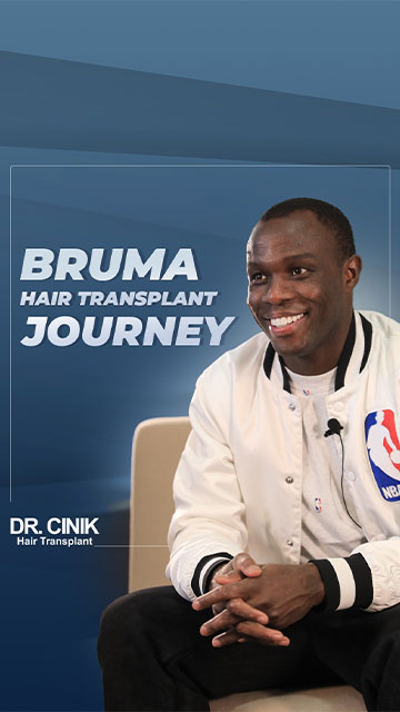 Bruma's hair transplant journey