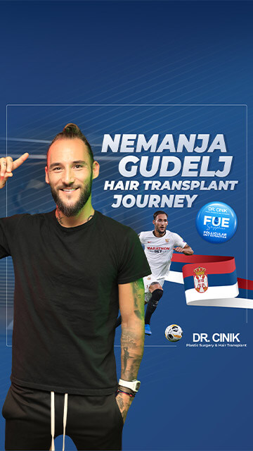 Nemanja Gudelj hair transplant