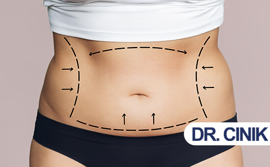 Choosing A Tummy Tuck After Pregnancy, Reversing The Physical Impact - Dr.  Kulick