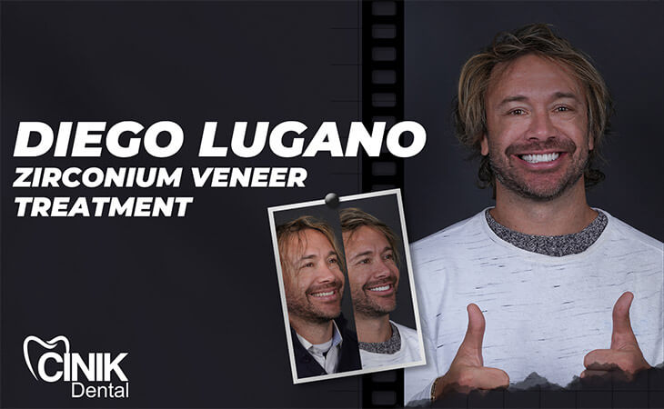 Diego Lugano