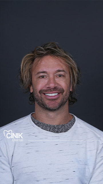 Diego Lugano dental transformation