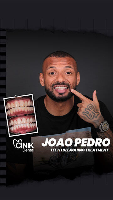 Joao Pedro dental transformation