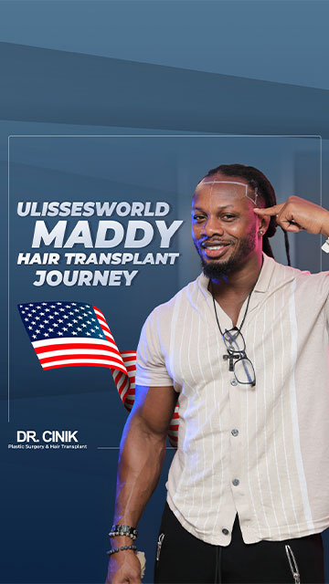 Ulisses Maddy hair transplant at Dr cinik clinic