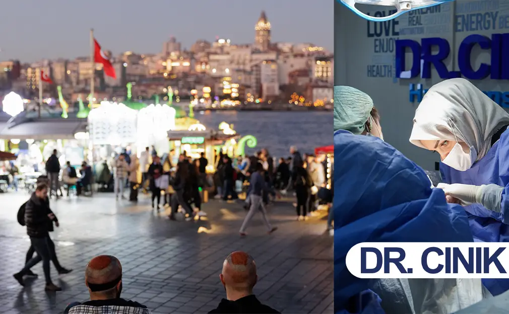 زراعة الشعر في إسطنبول