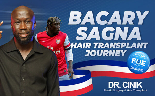Bacary Sagna's hair transplant journey in Turkey