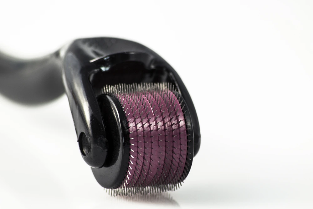 microneedling for hair loss