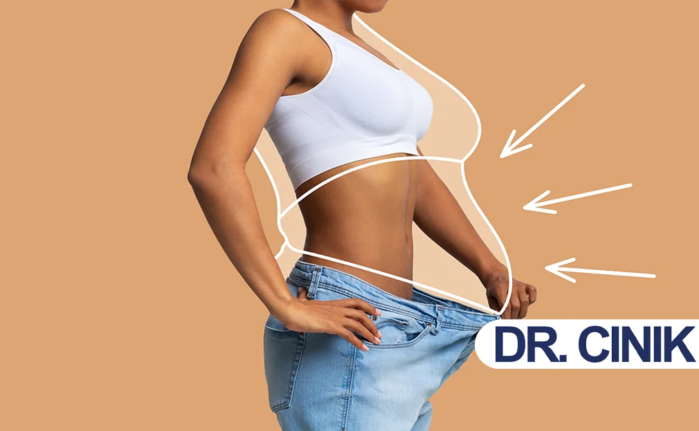 Liposuction cost in Turkey and misconceptions