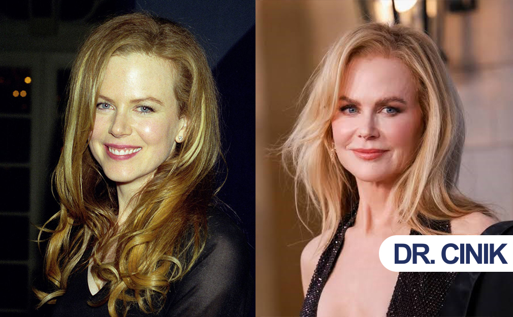 nicole kidman