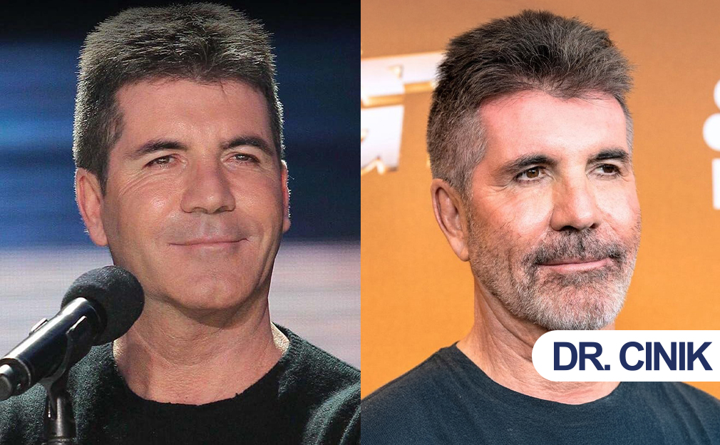 simon cowell