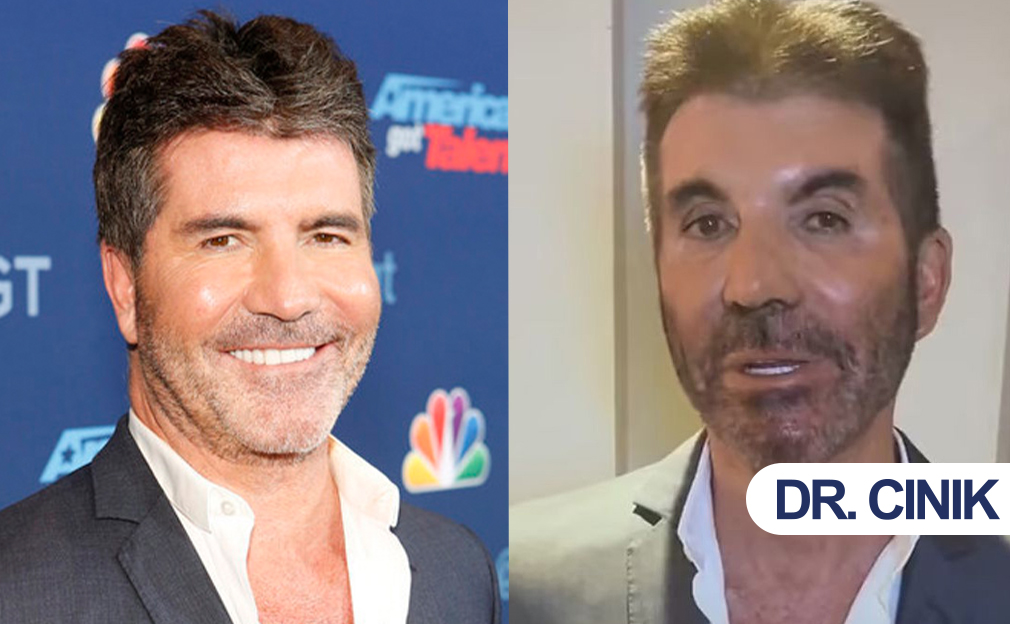simon cowell