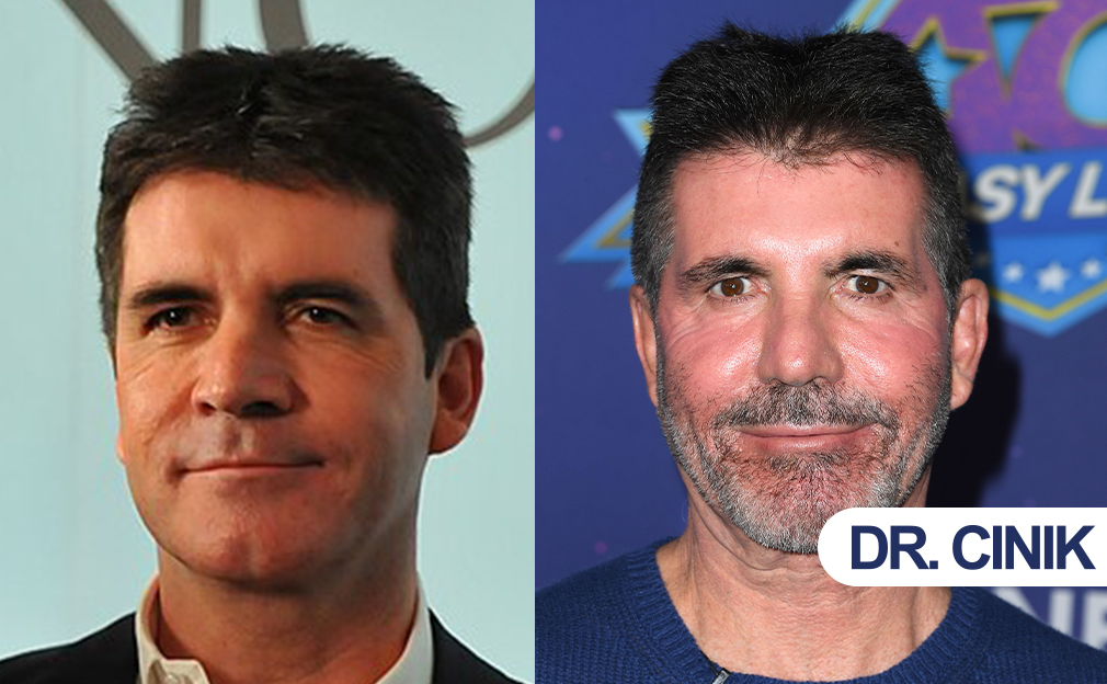 simon cowell