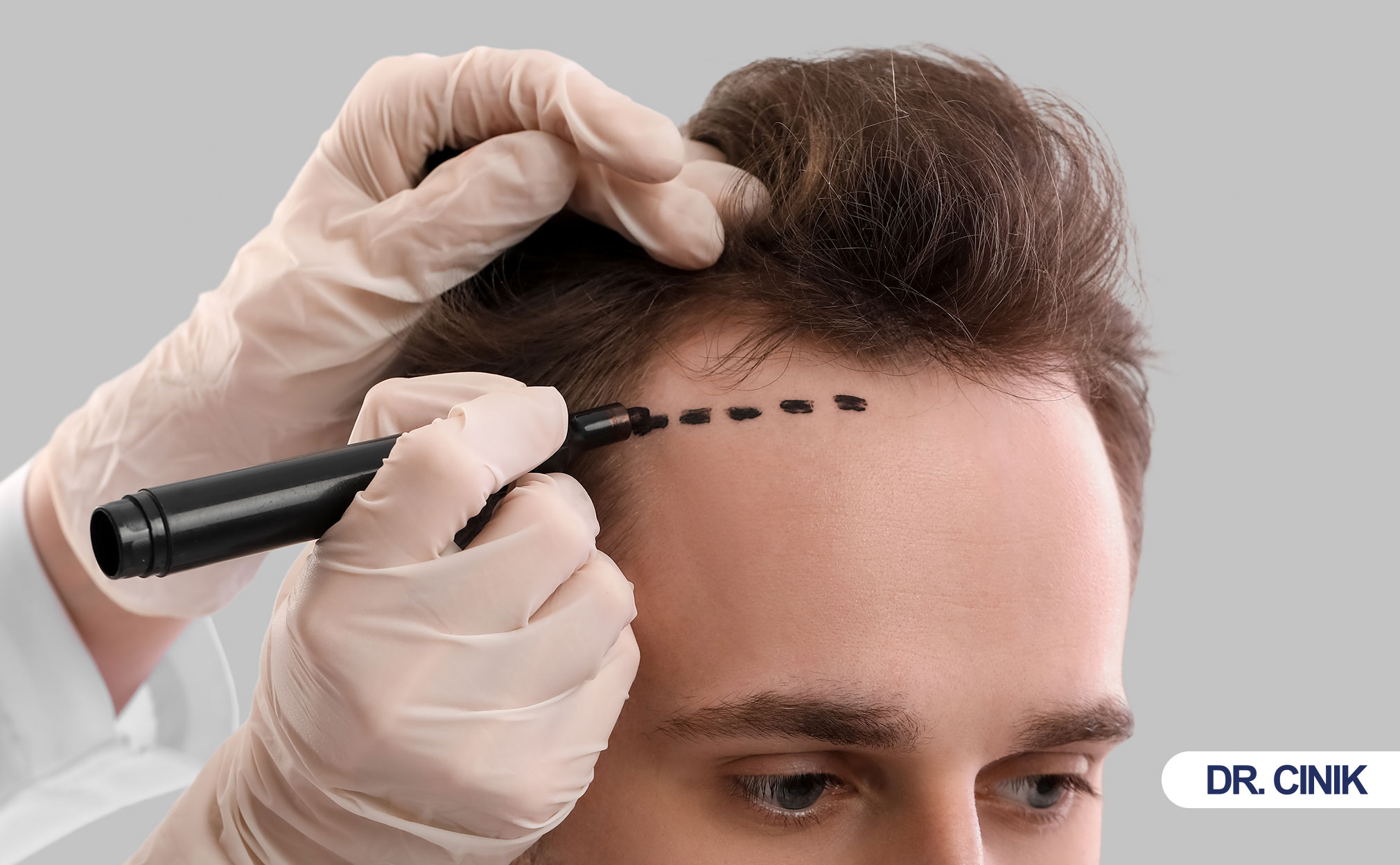 hair transplant cost