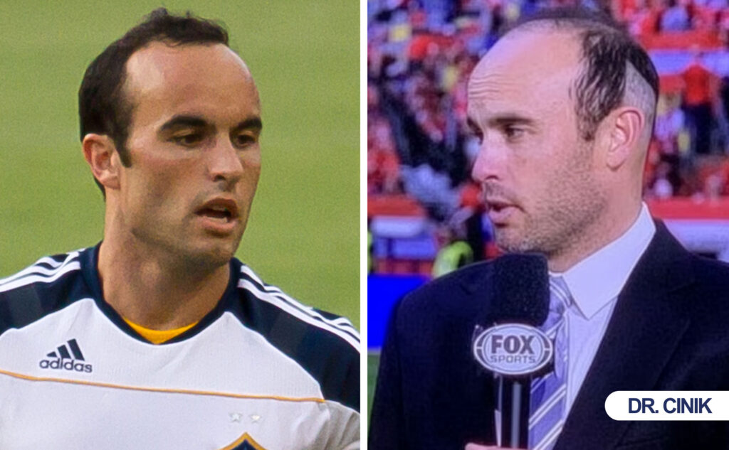 landon donovan