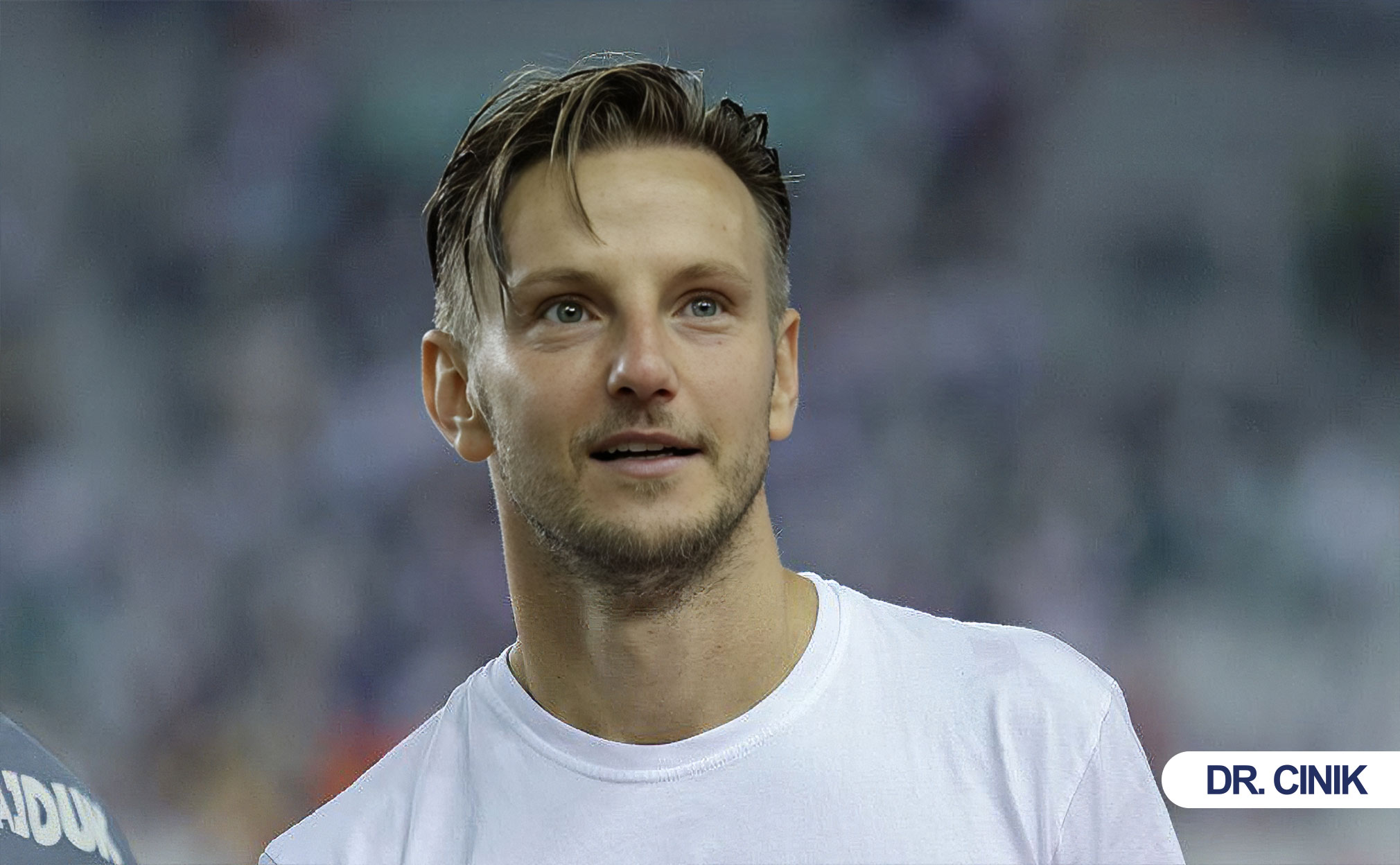 ivan rakitic hair transplant