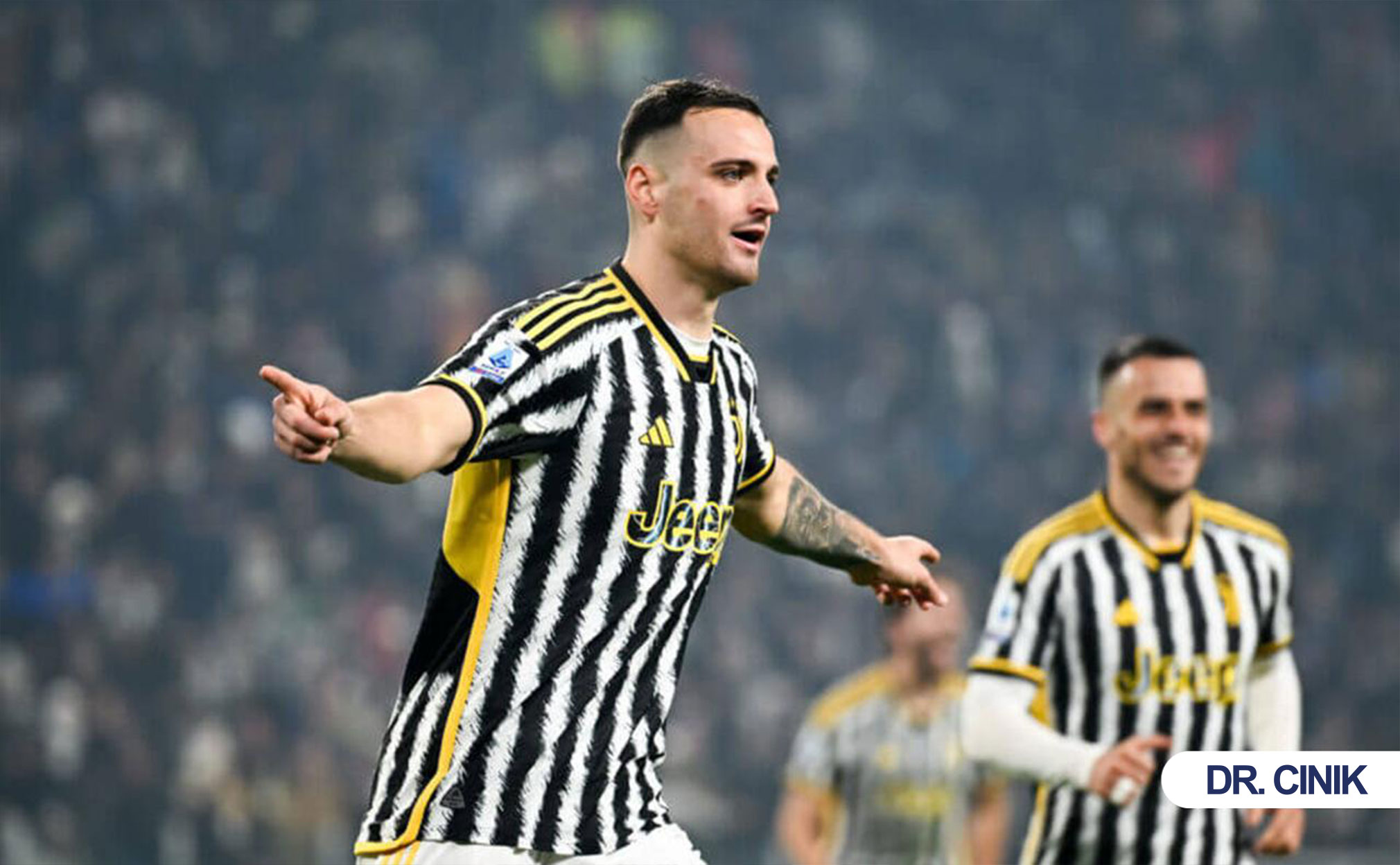 gatti hair transplant