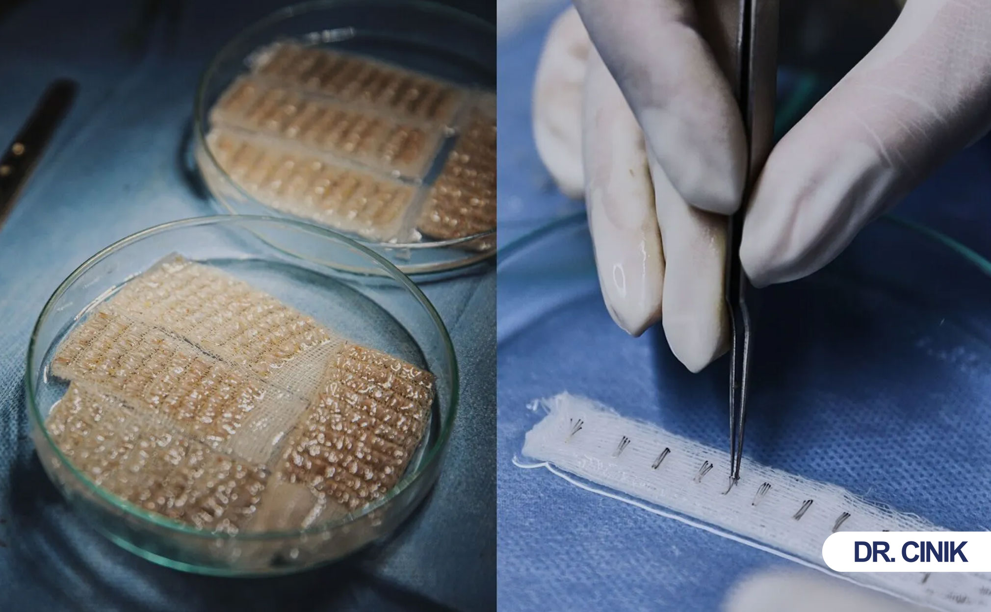 manuel-fue-hair-transplant