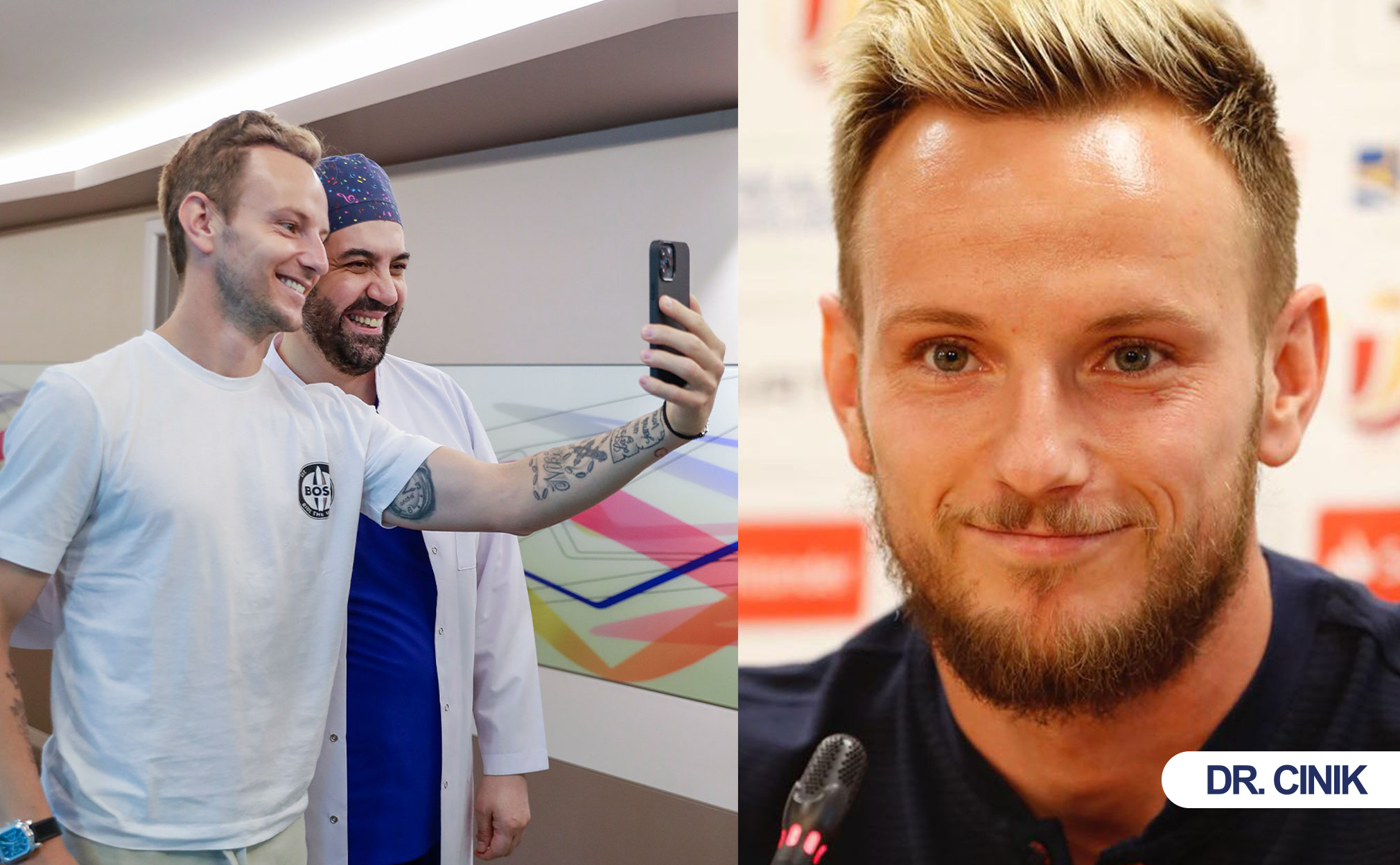 ivan rakitic hair transplant