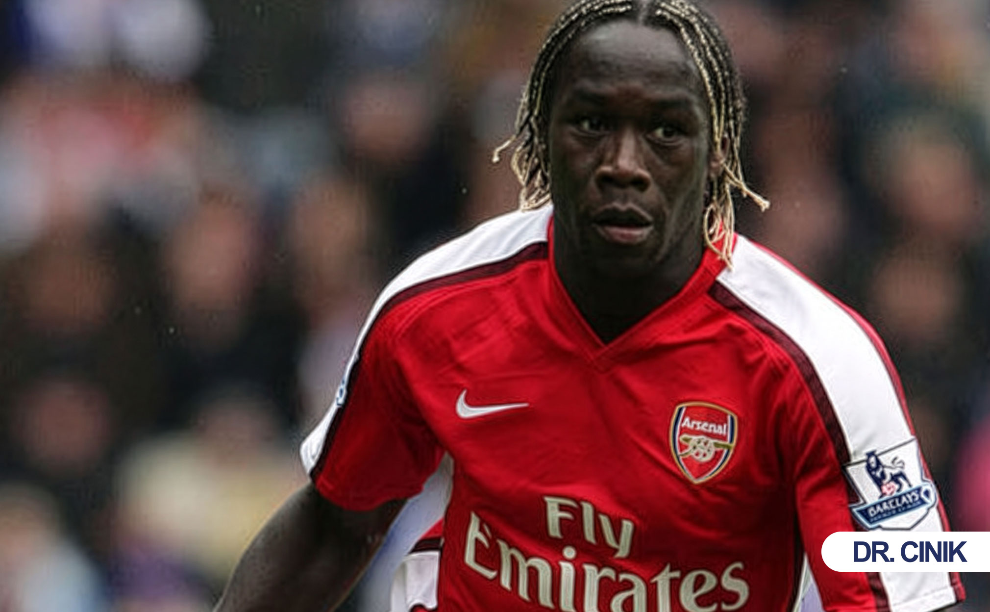 sagna hair transplant