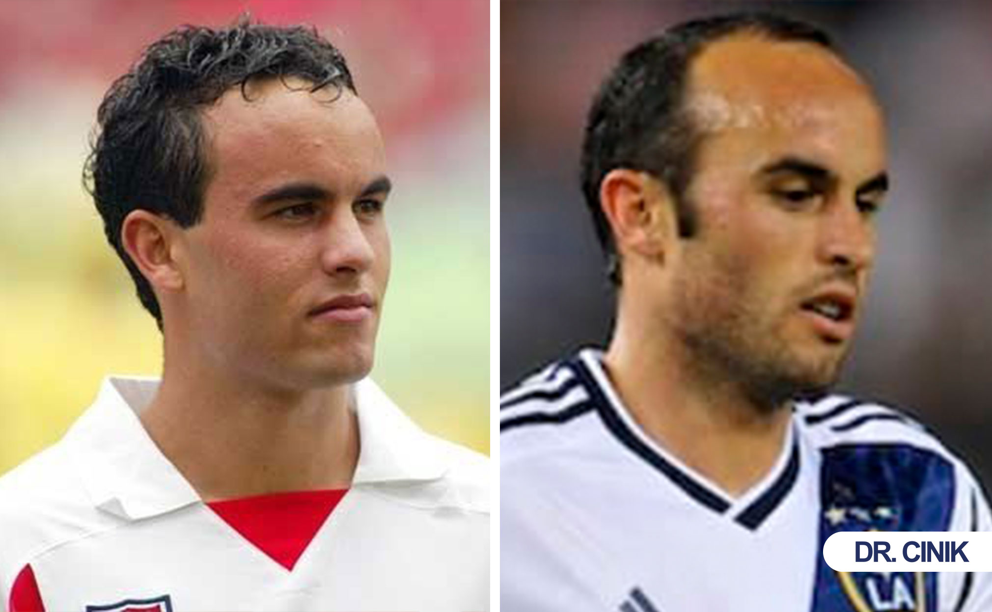 landon donovan