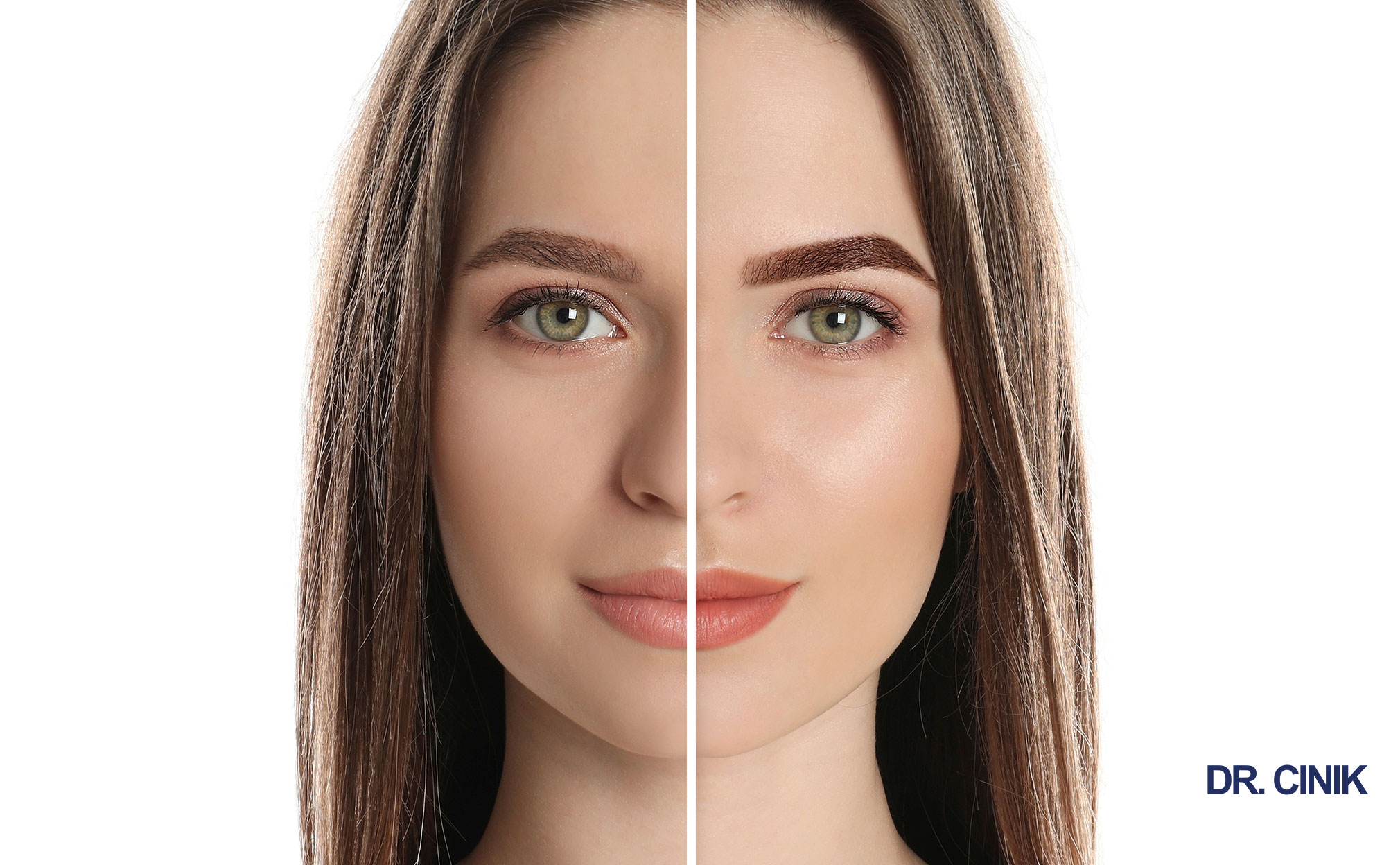 eyebrow hair transplant